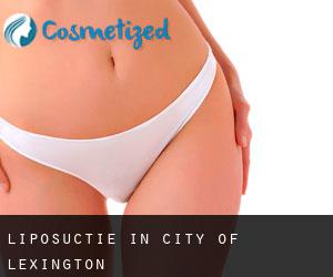 Liposuctie in City of Lexington