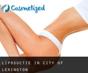 Liposuctie in City of Lexington