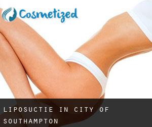 Liposuctie in City of Southampton