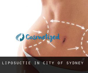 Liposuctie in City of Sydney