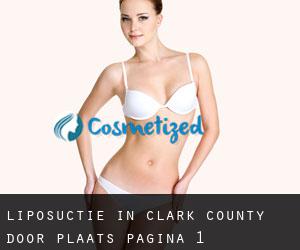 Liposuctie in Clark County door plaats - pagina 1