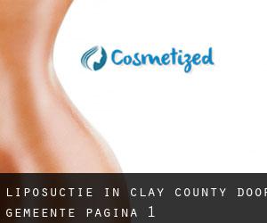 Liposuctie in Clay County door gemeente - pagina 1