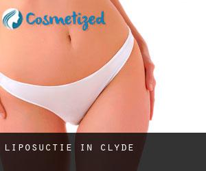 Liposuctie in Clyde