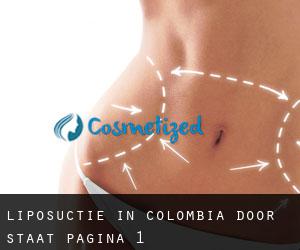 Liposuctie in Colombia door Staat - pagina 1