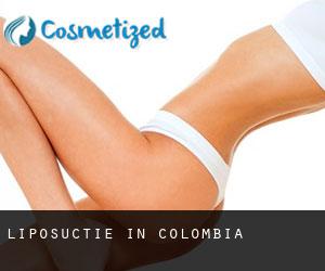 Liposuctie in Colombia