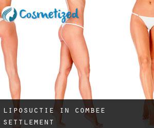 Liposuctie in Combee Settlement