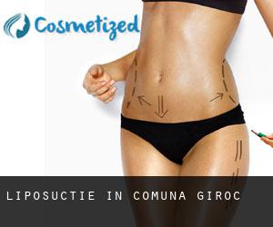 Liposuctie in Comuna Giroc