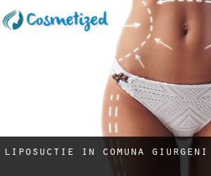 Liposuctie in Comuna Giurgeni