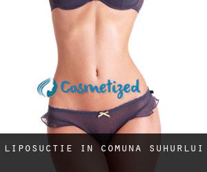 Liposuctie in Comuna Suhurlui