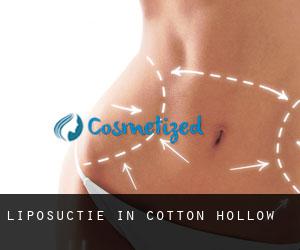 Liposuctie in Cotton Hollow