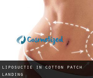 Liposuctie in Cotton Patch Landing