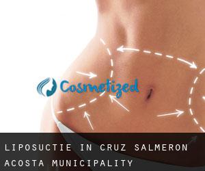 Liposuctie in Cruz Salmerón Acosta Municipality