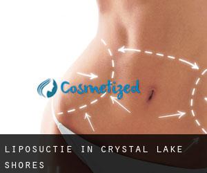 Liposuctie in Crystal Lake Shores