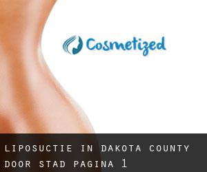 Liposuctie in Dakota County door stad - pagina 1
