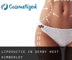 Liposuctie in Derby-West Kimberley