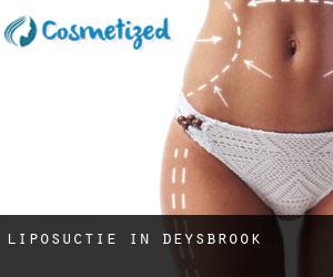Liposuctie in Deysbrook