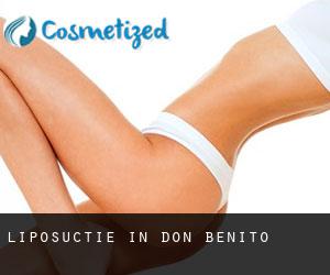 Liposuctie in Don Benito