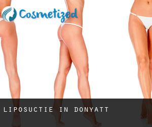 Liposuctie in Donyatt
