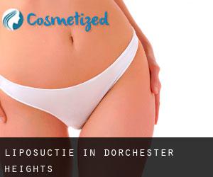 Liposuctie in Dorchester Heights