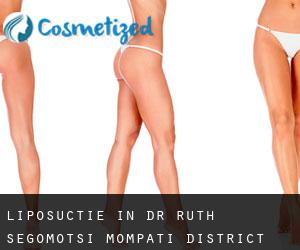 Liposuctie in Dr Ruth Segomotsi Mompati District Municipality door hoofd stad - pagina 1