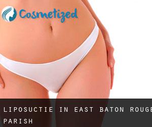 Liposuctie in East Baton Rouge Parish