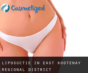 Liposuctie in East Kootenay Regional District