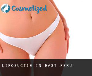 Liposuctie in East Peru