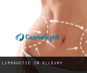 Liposuctie in Ellejoy