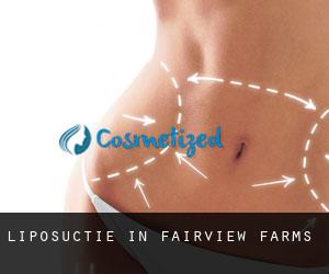 Liposuctie in Fairview Farms