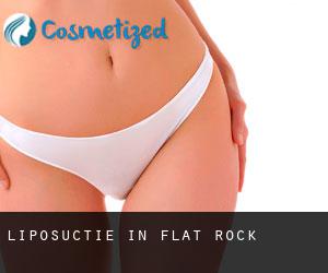 Liposuctie in Flat Rock