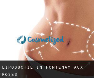 Liposuctie in Fontenay-aux-Roses