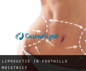 Liposuctie in Foothills M.District