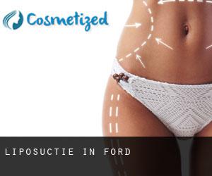 Liposuctie in Ford