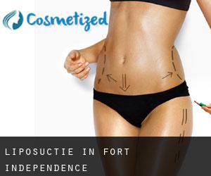Liposuctie in Fort Independence