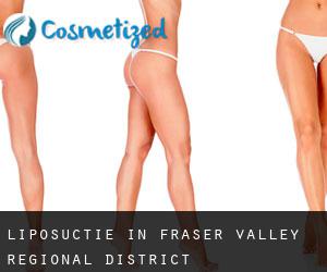 Liposuctie in Fraser Valley Regional District
