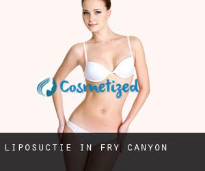 Liposuctie in Fry Canyon