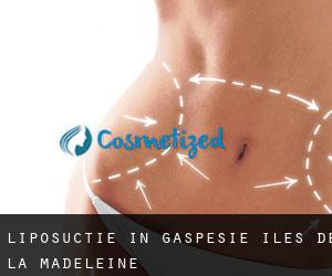 Liposuctie in Gaspésie-Îles-de-la-Madeleine