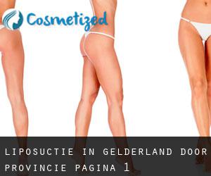 Liposuctie in Gelderland door Provincie - pagina 1