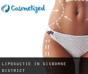 Liposuctie in Gisborne District