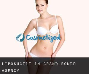 Liposuctie in Grand Ronde Agency