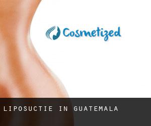 Liposuctie in Guatemala