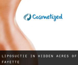 Liposuctie in Hidden Acres of Fayette