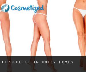 Liposuctie in Holly Homes