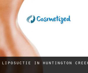 Liposuctie in Huntington Creek