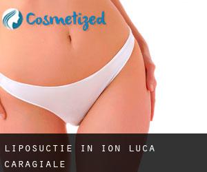 Liposuctie in Ion Luca Caragiale