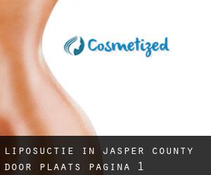 Liposuctie in Jasper County door plaats - pagina 1