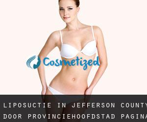 Liposuctie in Jefferson County door provinciehoofdstad - pagina 4