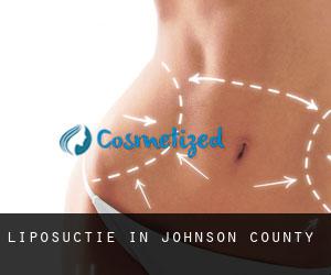 Liposuctie in Johnson County