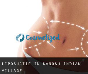 Liposuctie in Kanosh Indian Village