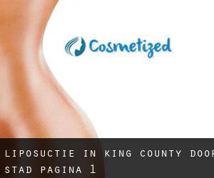 Liposuctie in King County door stad - pagina 1